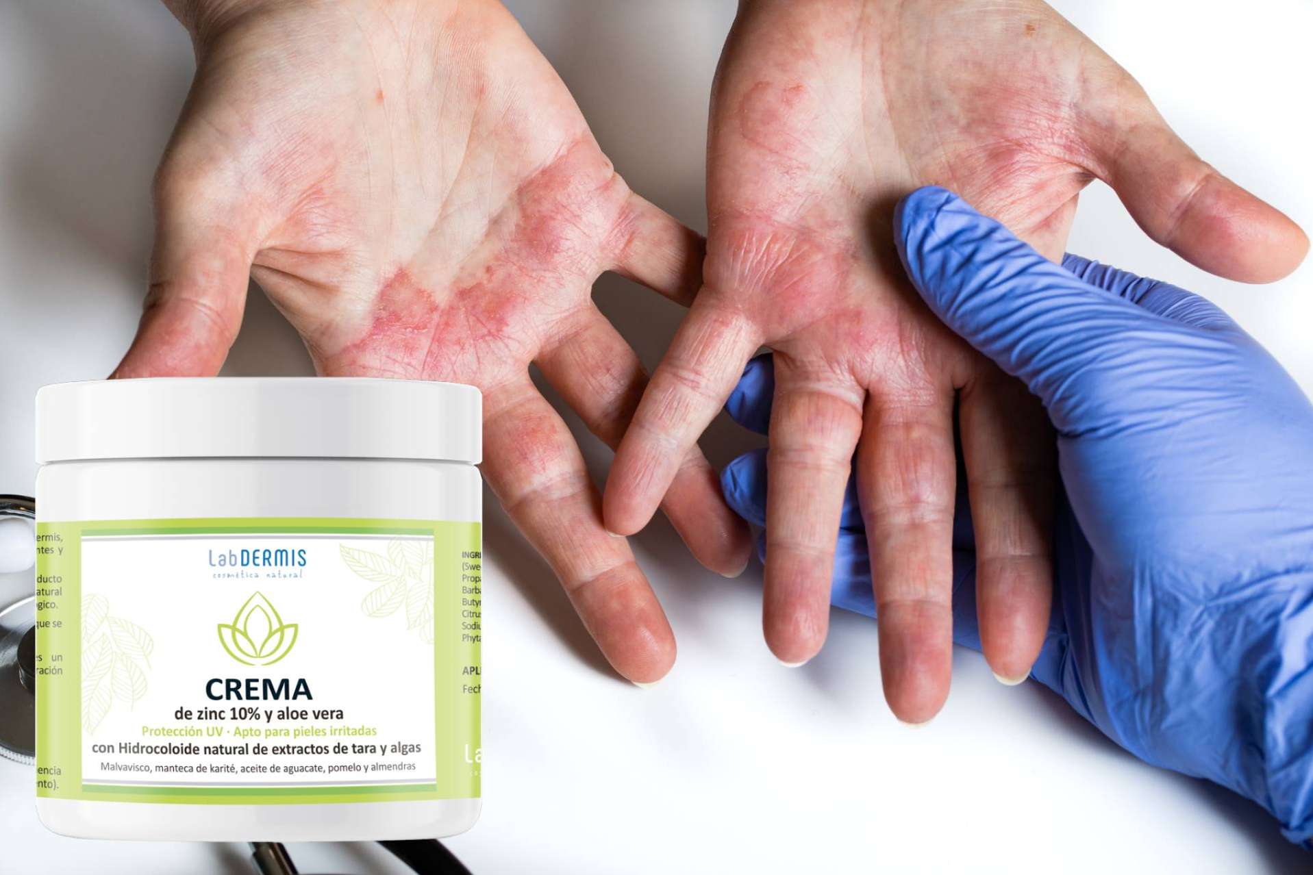 ¿Se puede confiar en la cosmética natural para cuidar la piel atópica con dermatitis? Responde LabDERMIS