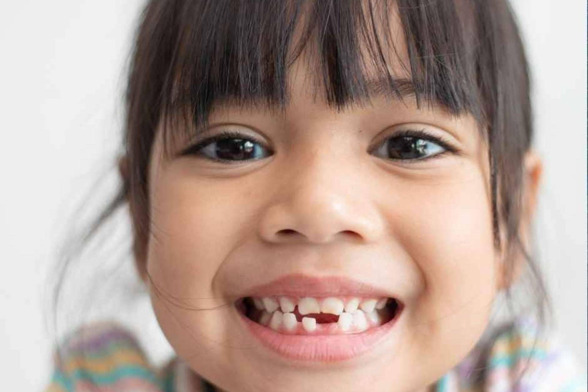 Caries en niños; la enfermedad infantil más común que pocos padres vigilan